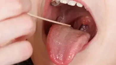 How To Know What's Normal For Your Mouth
