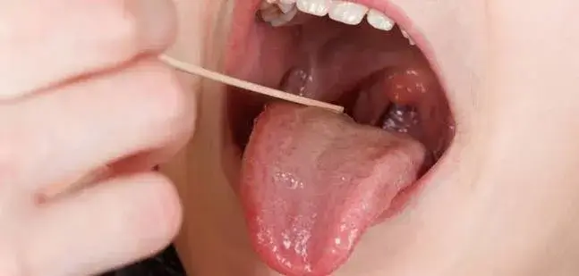 How To Know What's Normal For Your Mouth